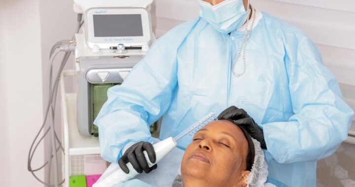 How to Treat Acne Scars: A Step-by-Step Guide